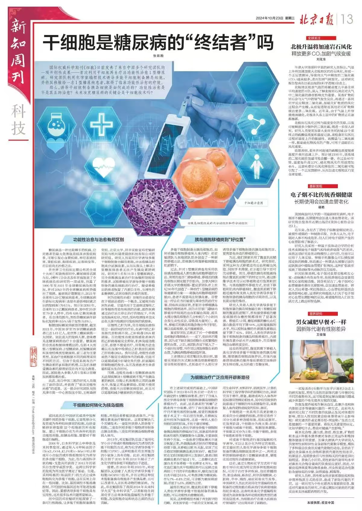 北京日报发文：干细胞是糖尿病的“终结者”吗？